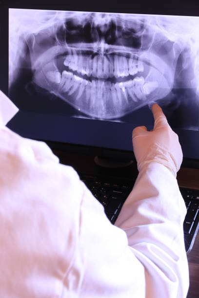 Best Dental Abscess Treatment in Anahuac, TX